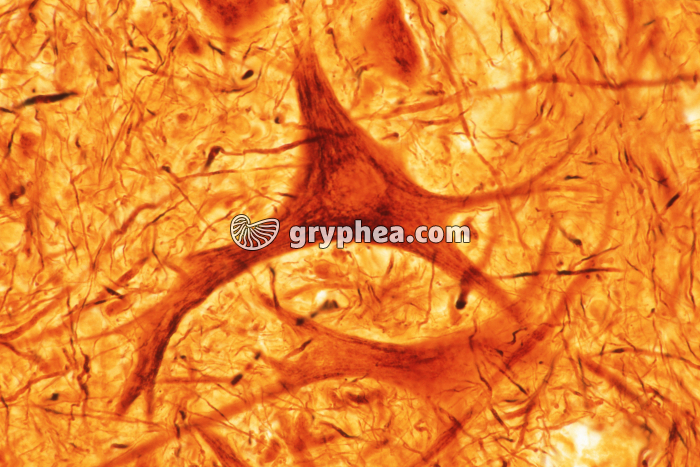 Neurone moteur de la moelle épinière x160 - gryphea.org